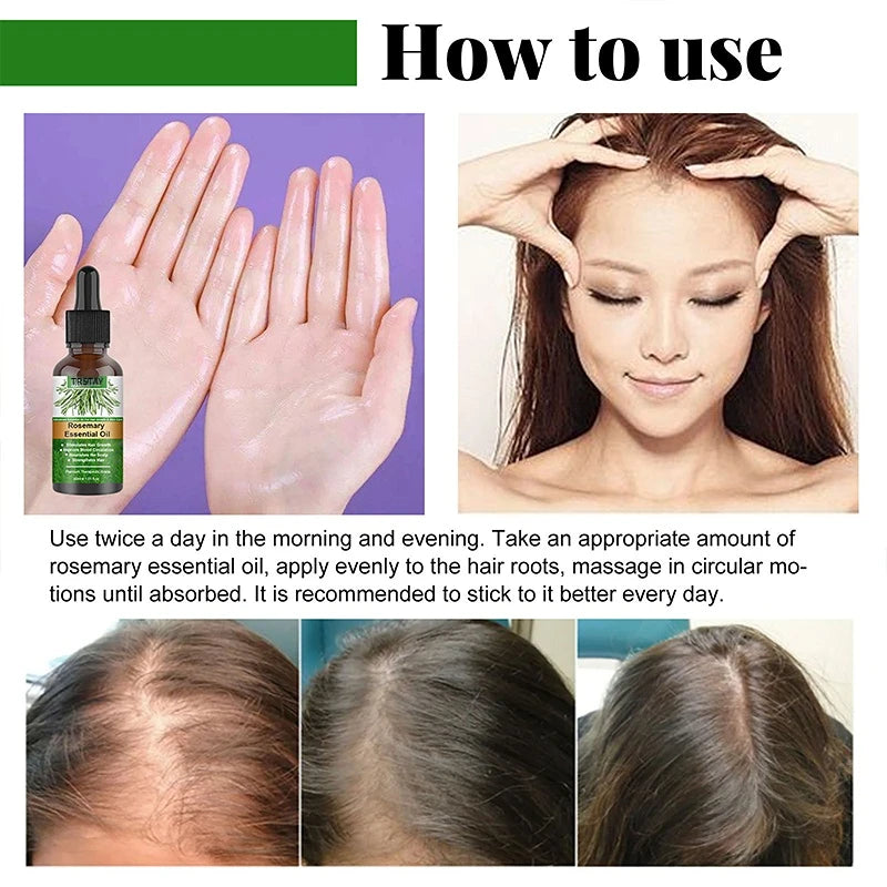 Hair Growth Oil Rosemary Essential Oil Anti-frizz Anti Hair Loss Hairs Smooth Serum Hairs Care Hairs Loss Treatments New Fashion