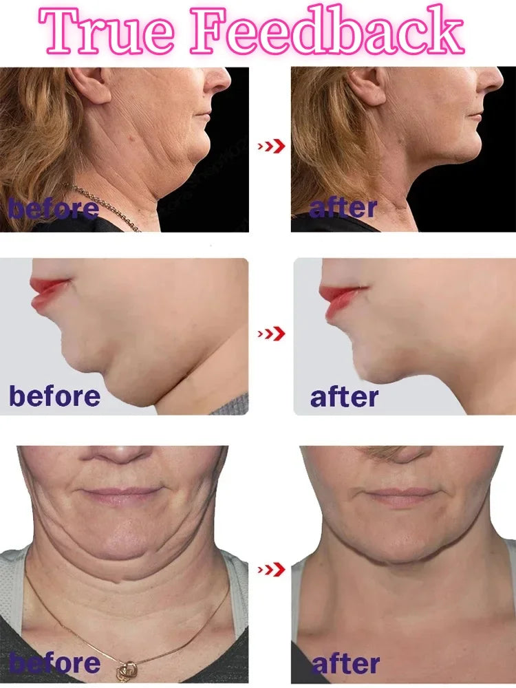 Effective V-Shape Face Slimming Cream Lift Up V Double Chin Cheek Slimming Firming Anti Wrinkle Reshaped Face Counter Skin Care