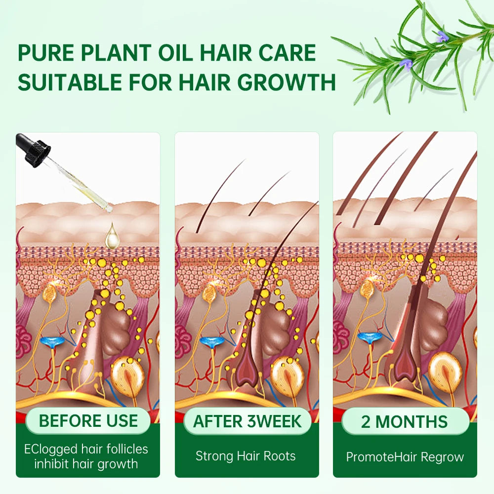 PURC Rosemary Oil Hair Growth for Men Women Fast Growing Products Essential Oils Ginger Anti Hair Loss Scalp Treatment Hair Care